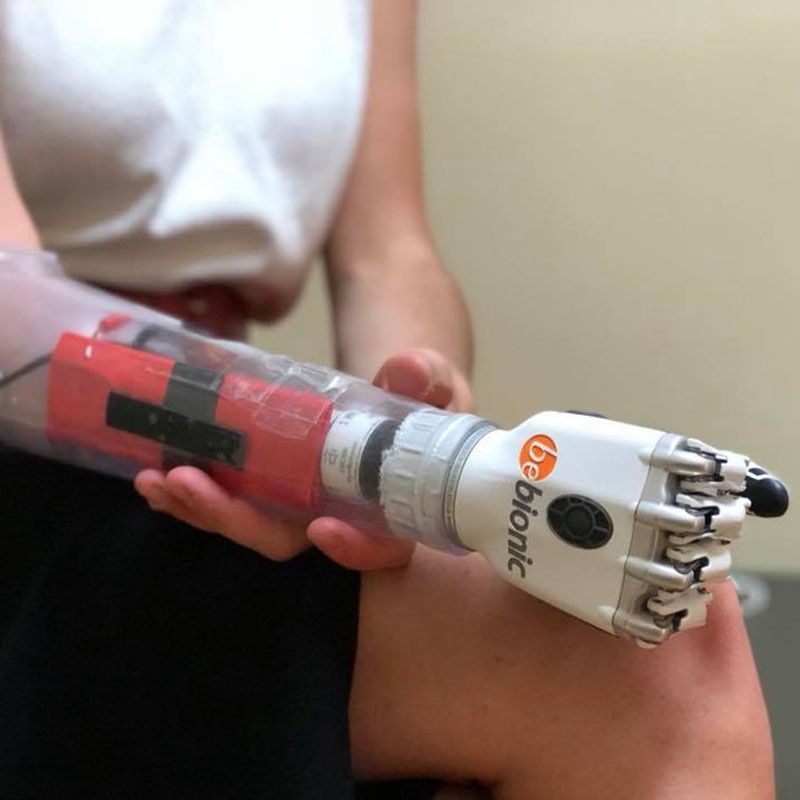 A person is holding a bionic device in their hand