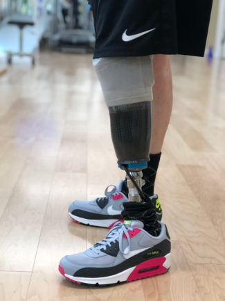 A person with a prosthetic leg is wearing nike shoes.