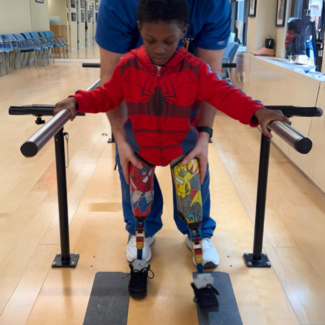 A boy walking using parallel bars has bilateral above the knee prostheses with pediatric mechanical knees