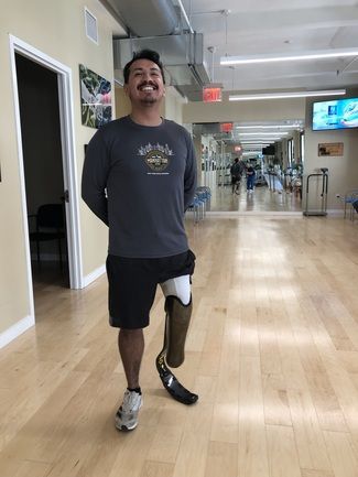 A man with a prosthetic leg is standing in a hallway.