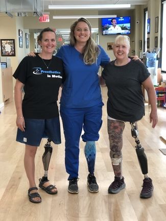 Three women with prosthetic legs are posing for a picture.