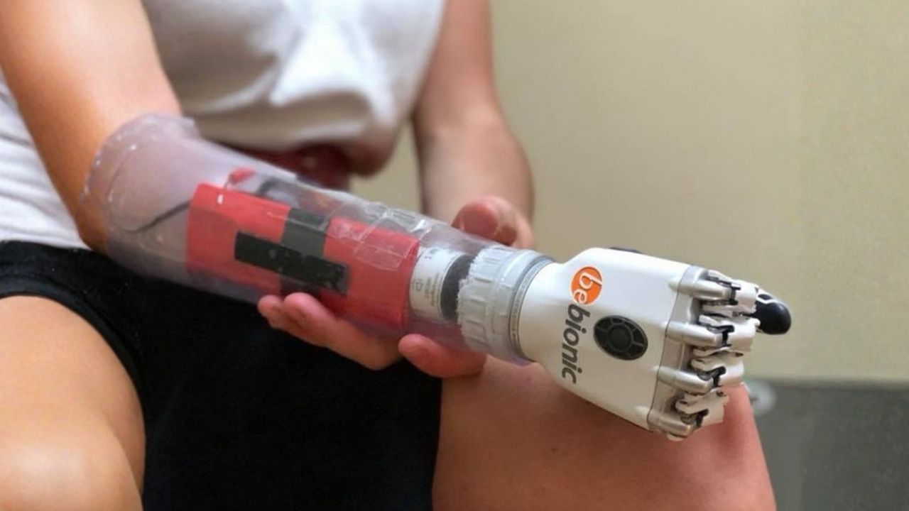 A person is holding their bebionic myoelectric hand.