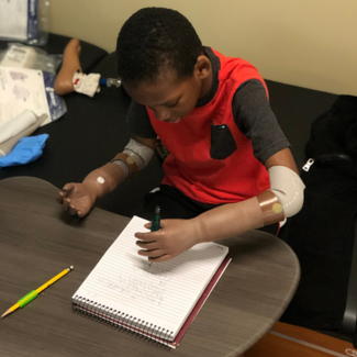 A boy with a prosthetic arm is writing in a notebook