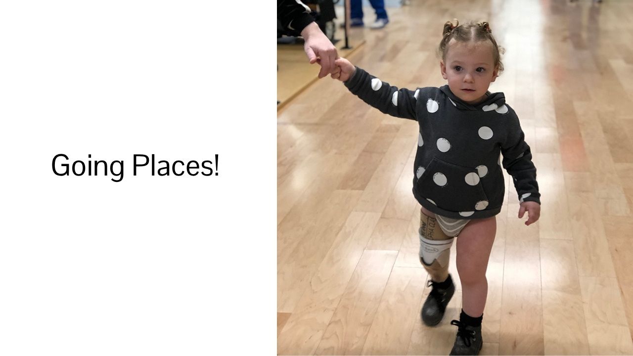 A little girl with a prosthetic leg is walking on a wooden floor.