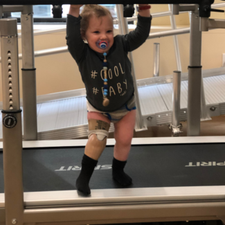 A baby that has a pediatric prosthetic leg is standing on a treadmill