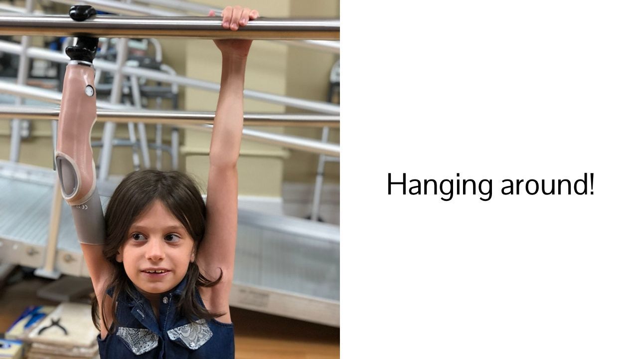 child hanging from a bar with a prosthetic arm