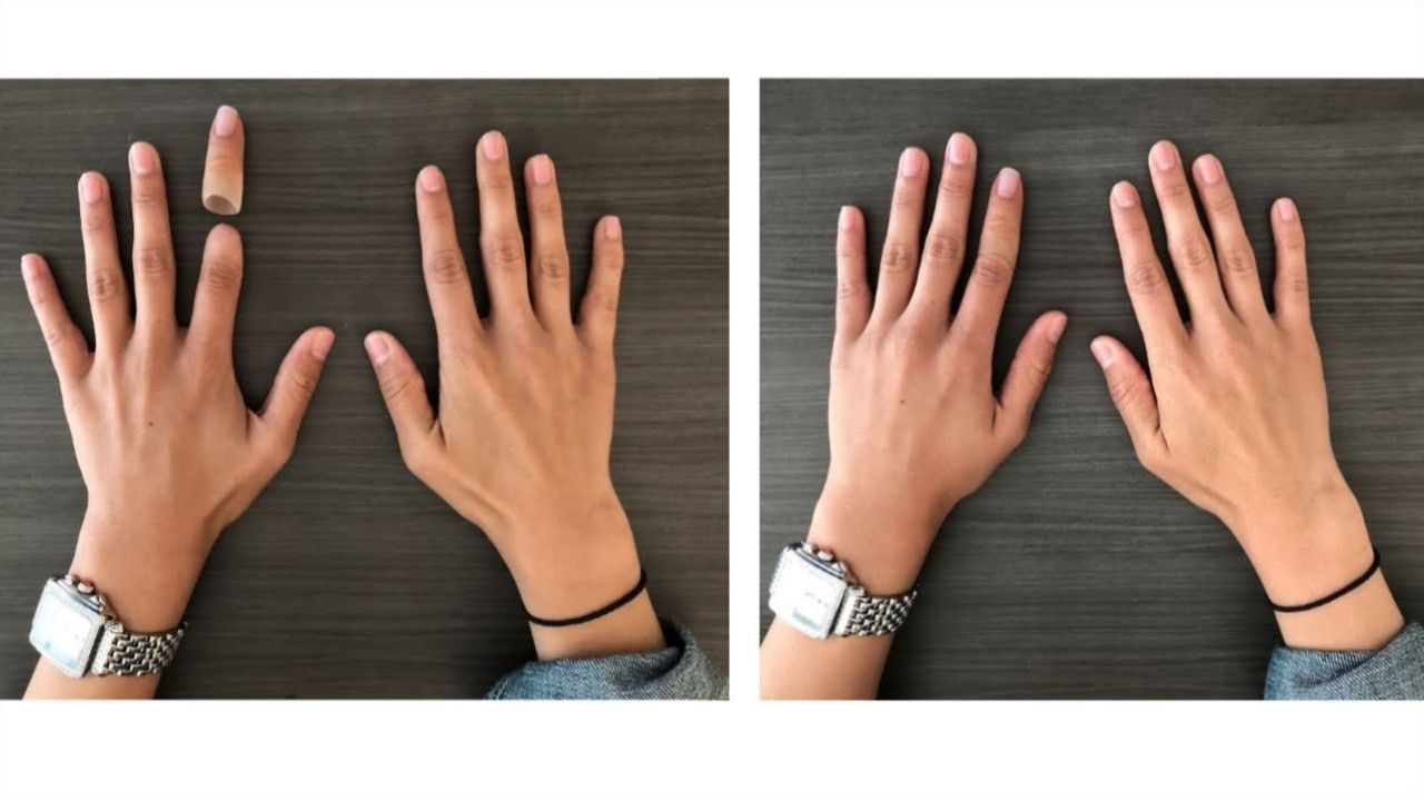 Before and after picture of a woman with a life-like silicone prosthetic finger.