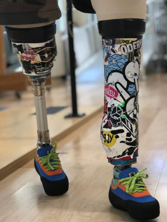 A person with rock climbing prosthetic legs