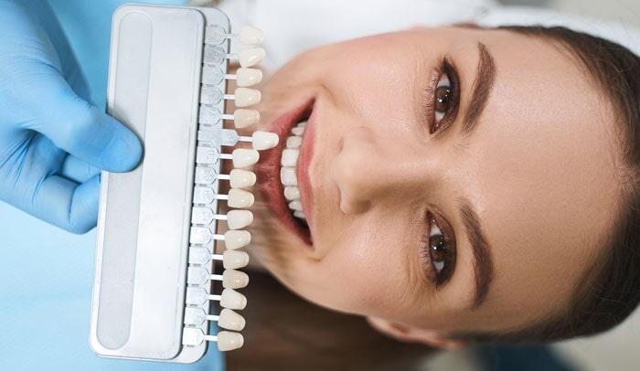 Dr. Miguel Ángel Estañol Ruíz - Carillas