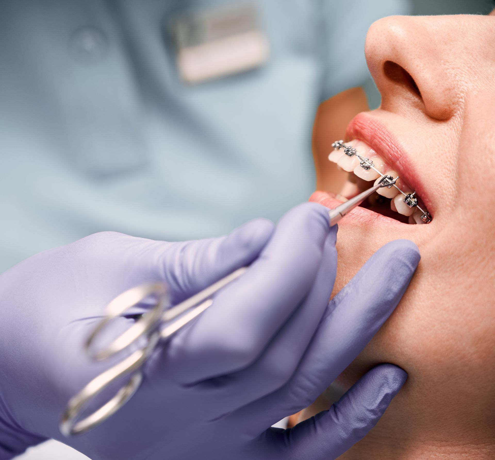 A dentist wearing blue nitrile gloves uses a dental tool to adjust metal braces on a patient's teeth.