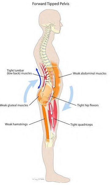 4 Key Exercises For Low Back Pain