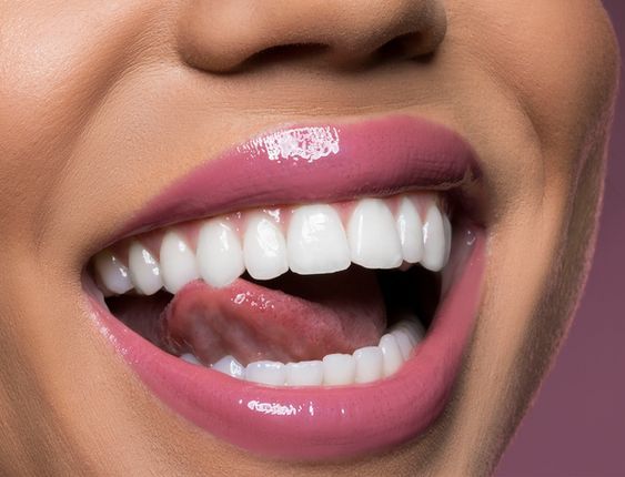 lentes de contato dentais prodonto