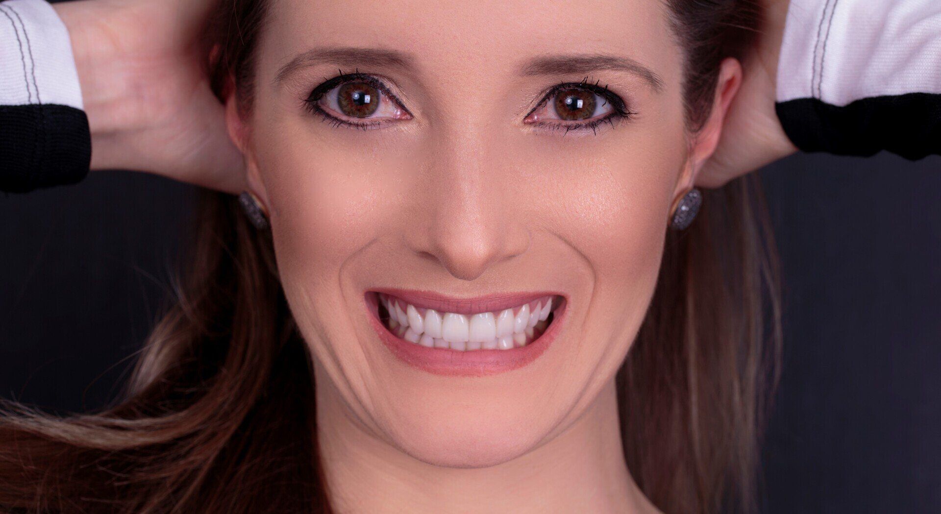 clareamento dental gengivoplastia prodonto