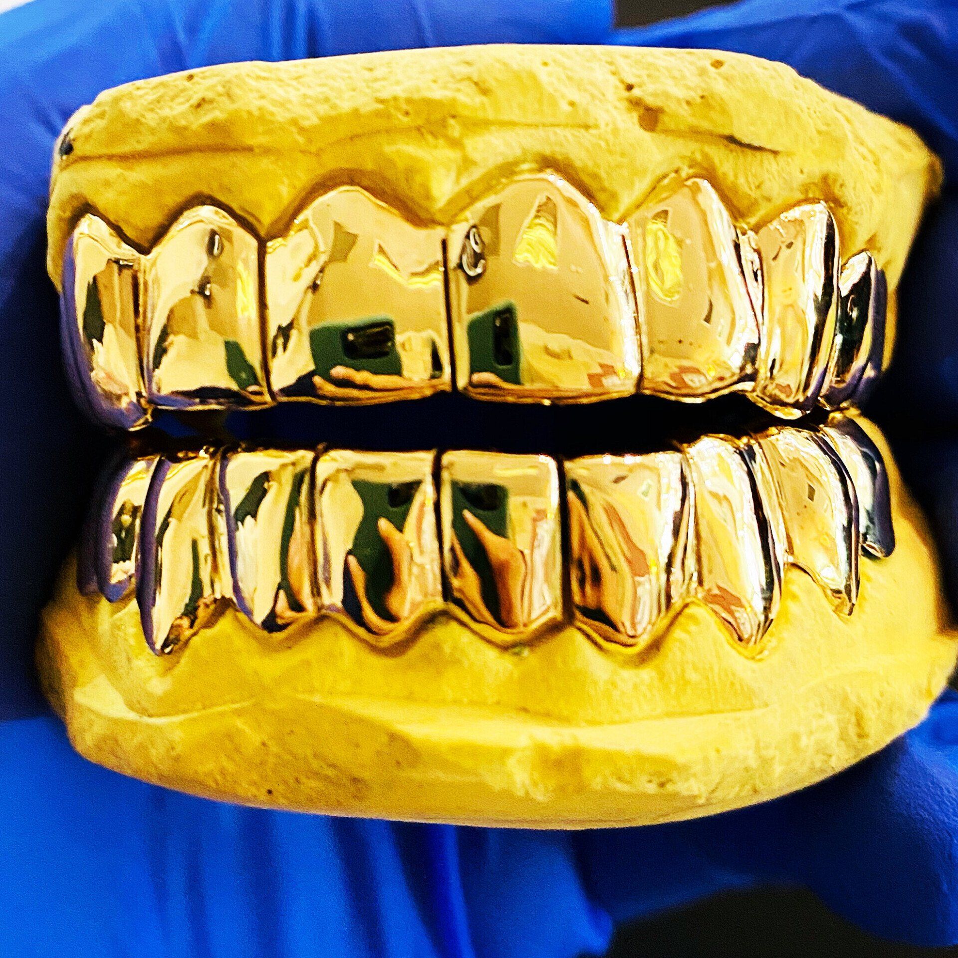 Custom Grillz at Ikonik Ink 24kt Gold Grillz Studio in Lakewood, CO