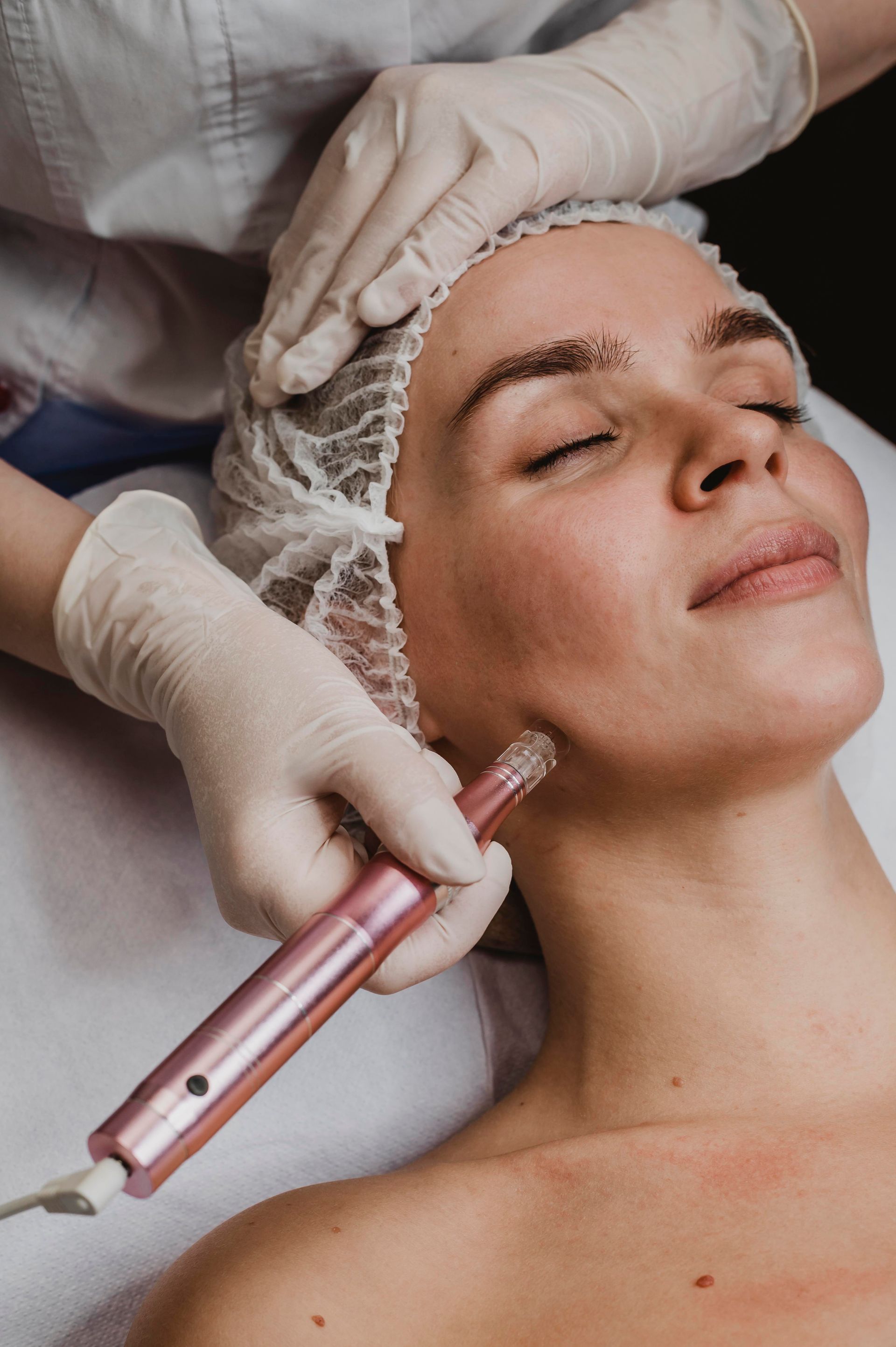 a woman is getting a facial treatment with a device that says ' derma pen ' on it