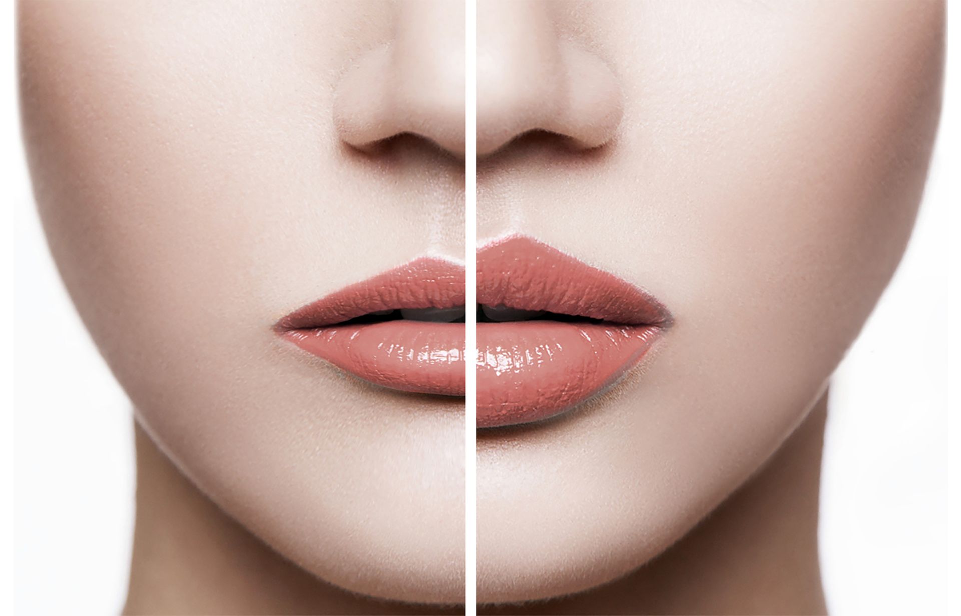 A before and after photo of a woman 's lips.
