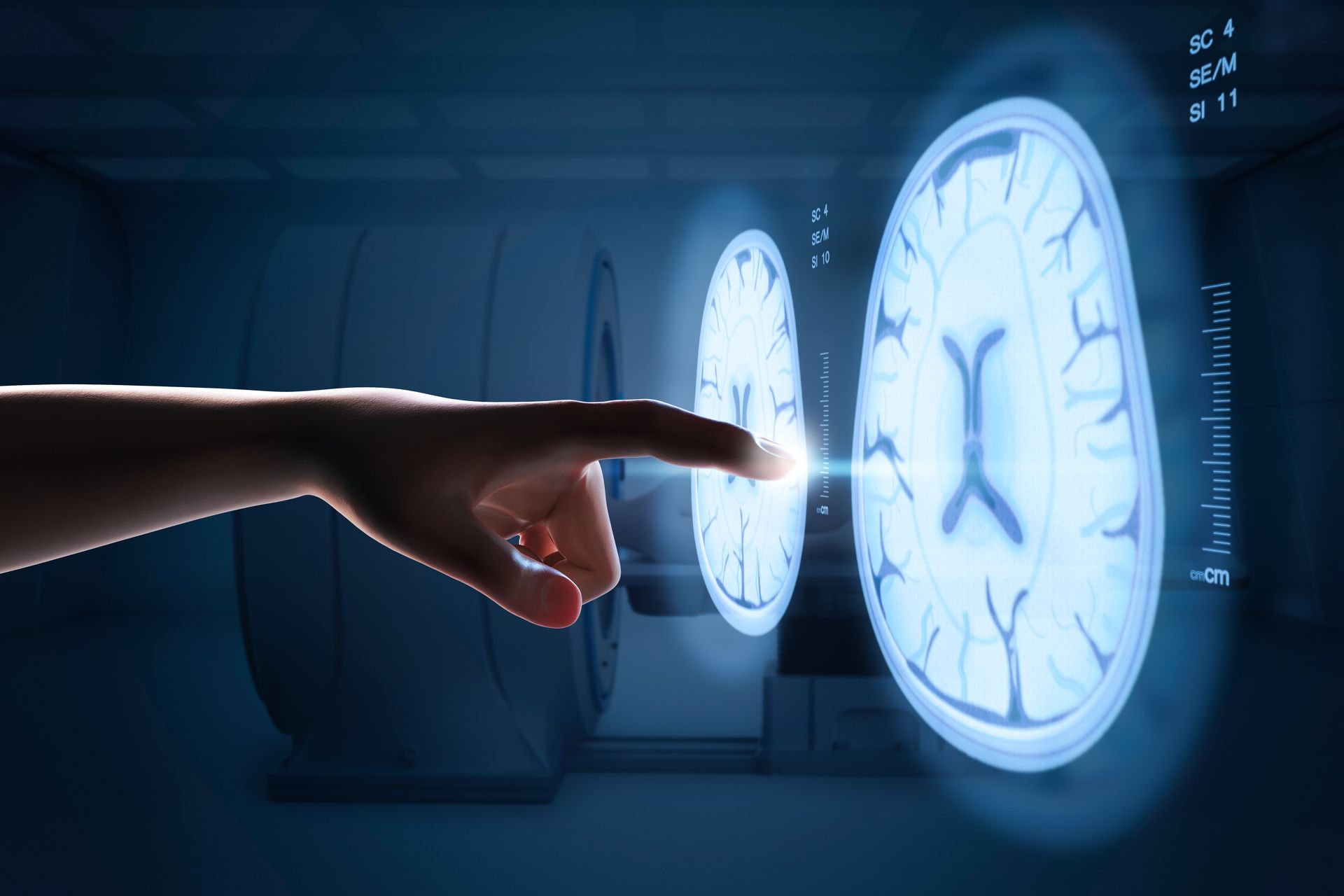 Quais os benefícios da estimulação magnética transcraniana para TOC em Belo Horizonte?