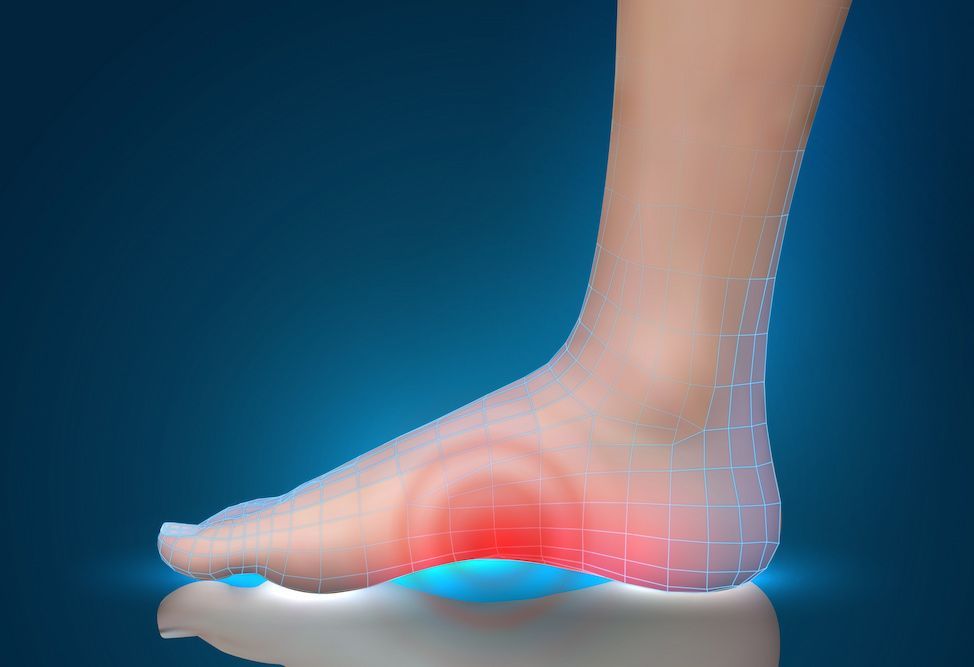 A Close up Of a Person 's Foot with A Red Spot on It — Swan Podiatry and Orthotics in Coconut Grove, NT