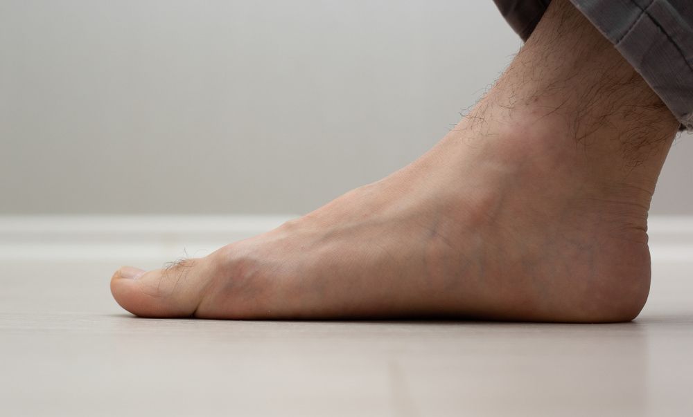 A Close up Of a Person 's Foot on A White Floor — Swan Podiatry and Orthotics in Coconut Grove, NT