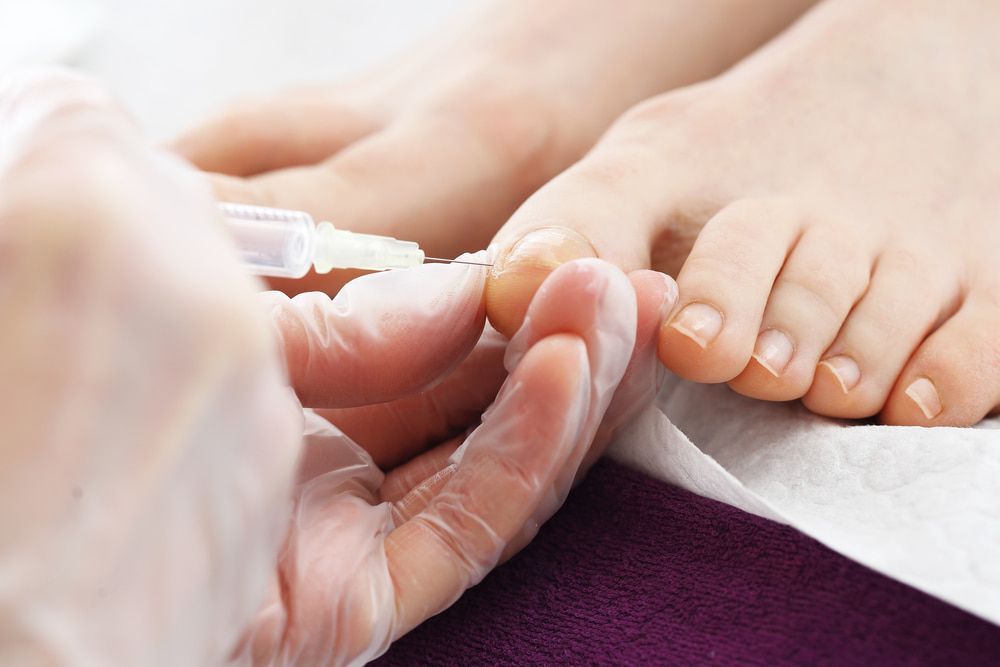 A Person Is Applying Nail Polish to A Woman 's Toenails — Swan Podiatry and Orthotics in Coconut Grove, NT