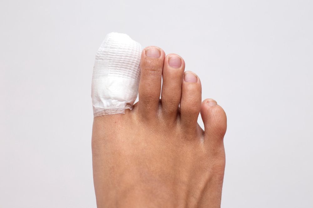 A Close up Of a Person 's Foot with A Bandage on The Toe — Swan Podiatry and Orthotics in Katherine, NT