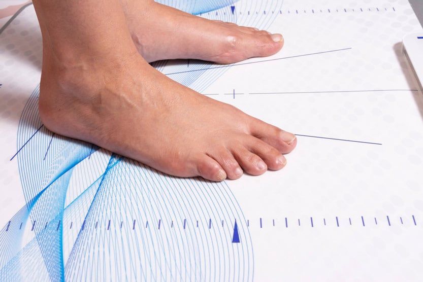 A Person's Foot Is Being Measured on A Piece of Paper — Swan Podiatry and Orthotics in Coconut Grov