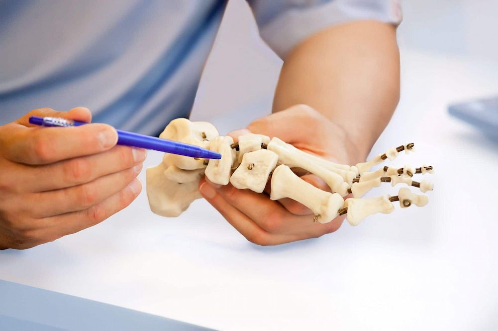 A Person Is Holding a Model of A Foot and Pointing at It with A Pen — Swan Podiatry and Orthotics in Coconut Grove, NT