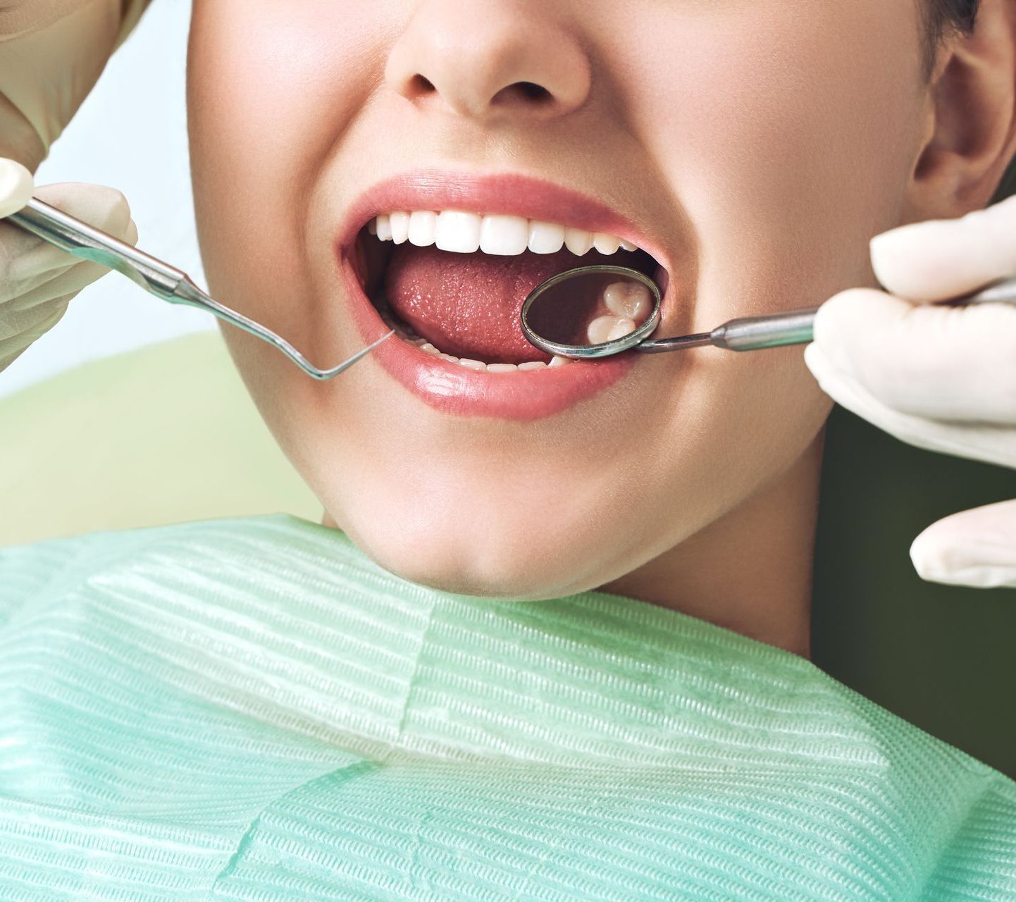 Woman with mouth open at dentist | Get composite fillings at our top biodentist clinic in morgantown wv