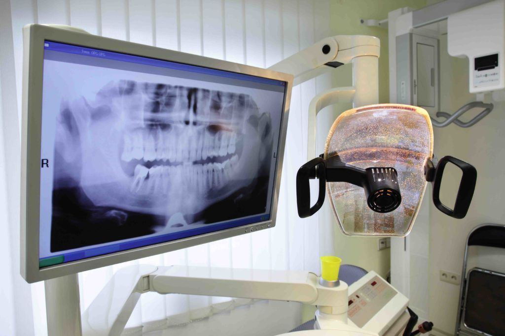 digital X-Ray | Best Natural Dentist Morgantown WV