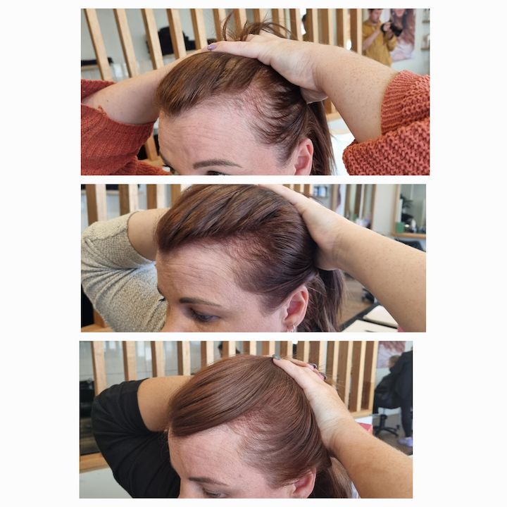 Three Images Of A Woman Showing Hair Growth After Using ROH — Arabella Hair Design in Sebastopol, VIC