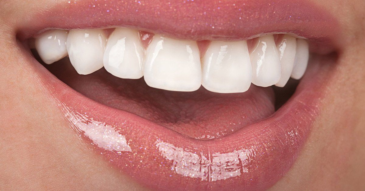 Ultimate Guide to Dental Bonding