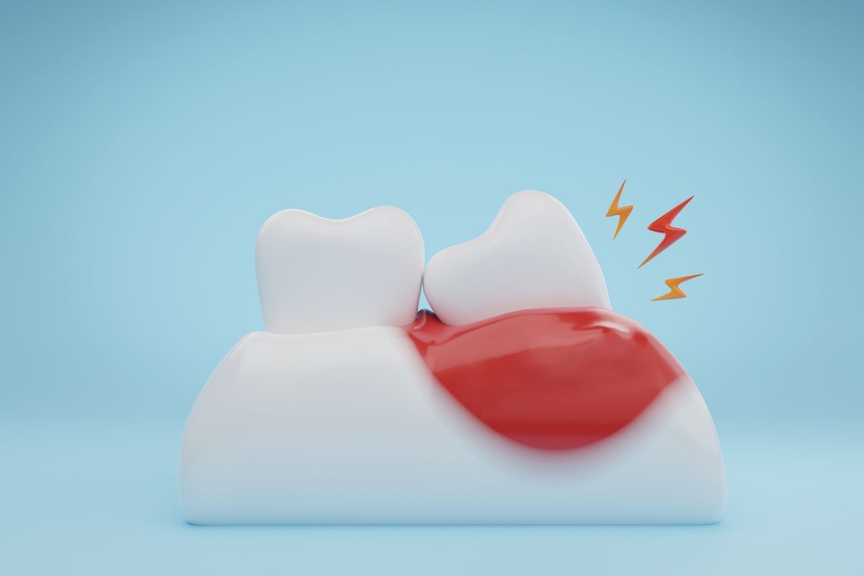 A 3d rendering of a tooth with a toothache.