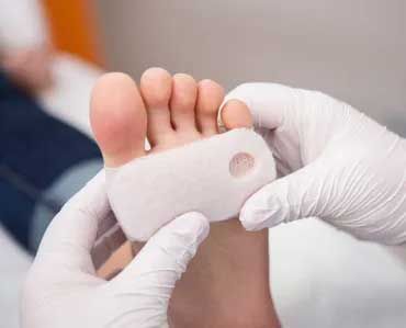 apply a white bandage to a patients foot