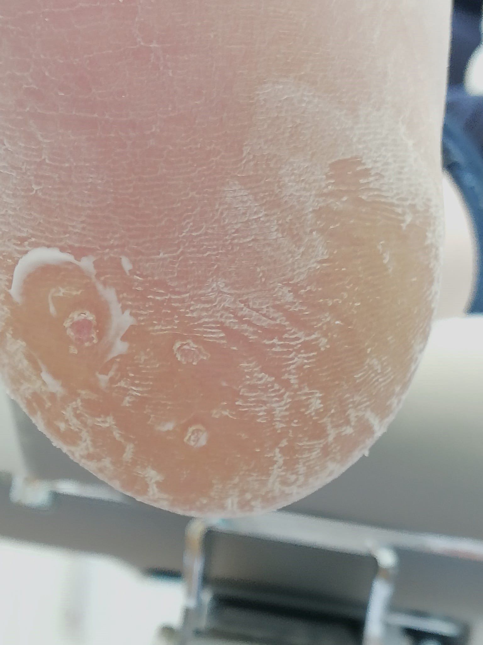 Kieferbehandlung CMD