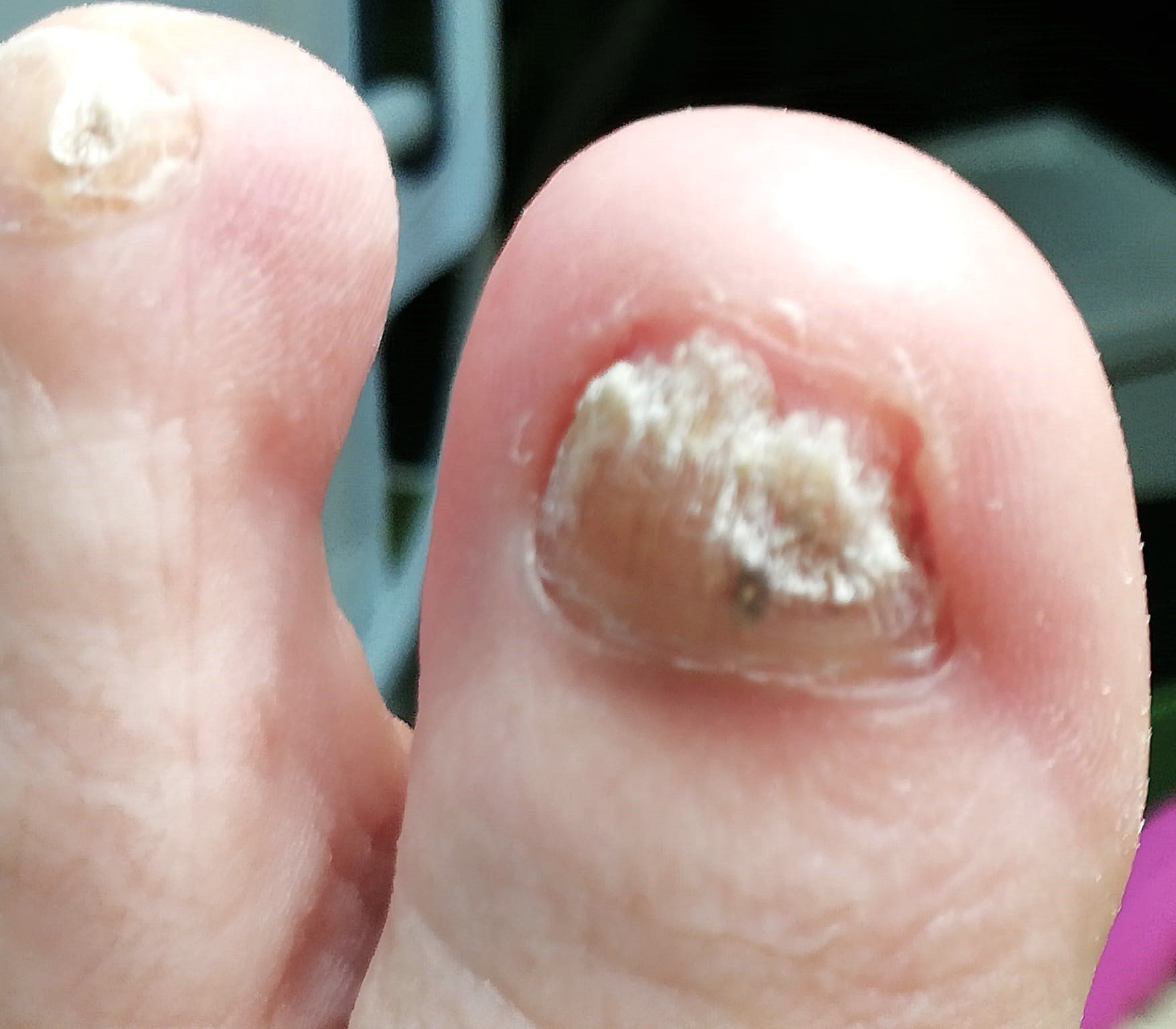 Fußreflexzonenmassage