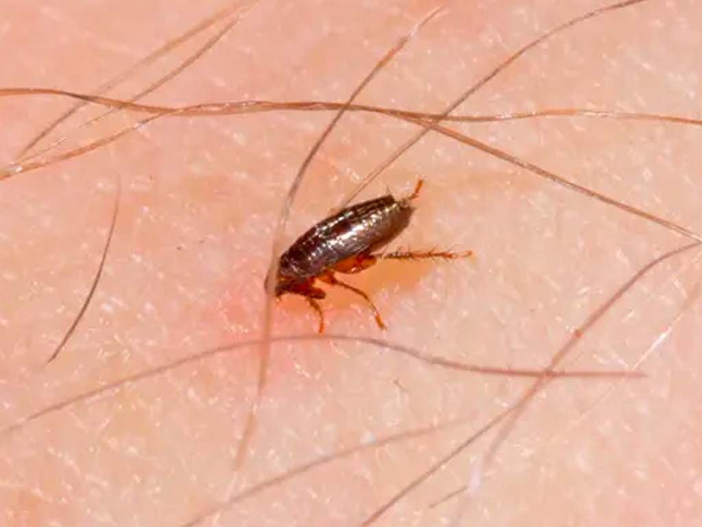 A flea is crawling on a person 's skin.