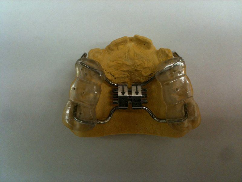 A close up of a dental device that looks like a piano keyboard