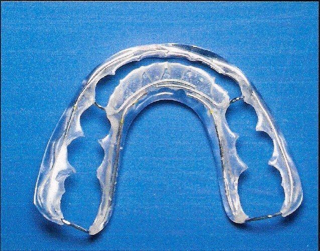 A clear plastic mouth guard is sitting on a blue surface.