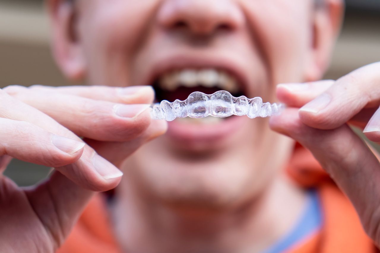 A man is holding a clear brace in his mouth.