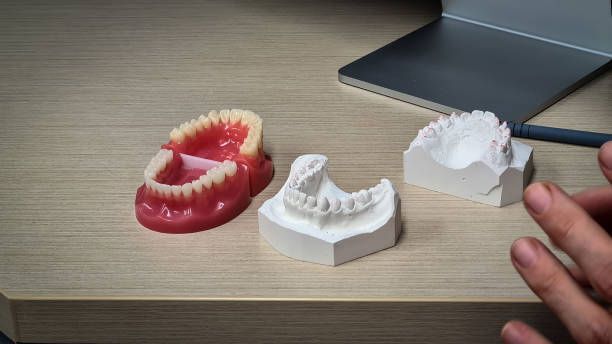 Three models of teeth are sitting on a wooden table.