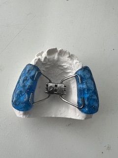 A close up of a dental brace on a tooth model on a table.