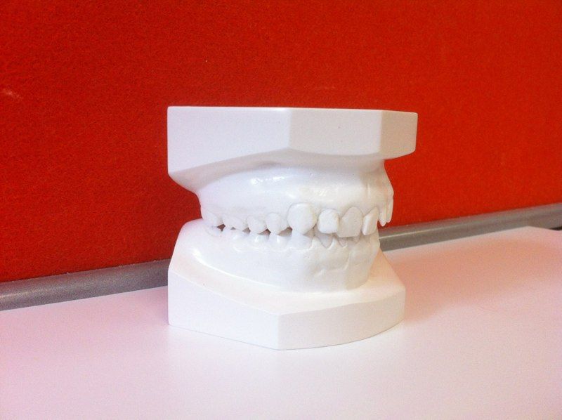 A model of a person 's teeth is sitting on a table
