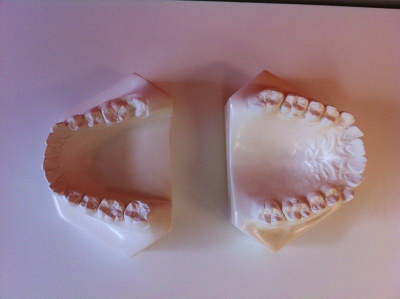 A pair of fake teeth are sitting on a white surface.