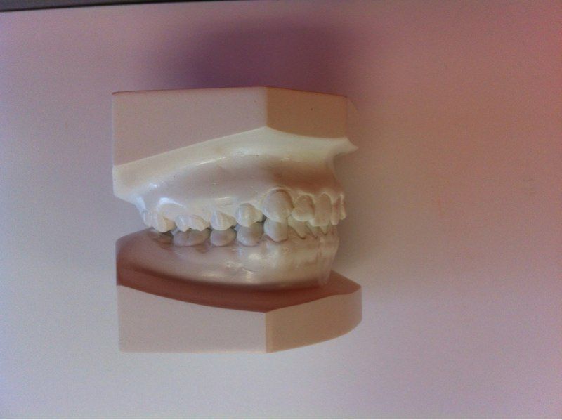A model of a person 's teeth is sitting on a table.