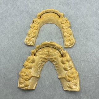 A model of a person 's teeth is sitting on a table