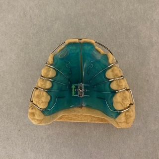 A model of a person 's teeth with braces on them.