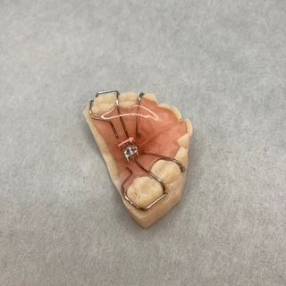 A close up of a tooth with braces on it on a table.