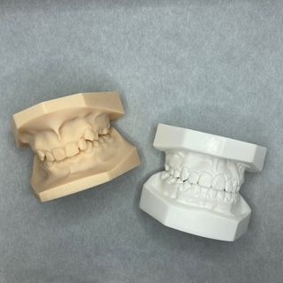 Two dental models are sitting next to each other on a table.