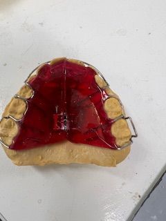 A close up of a dental brace on a table.