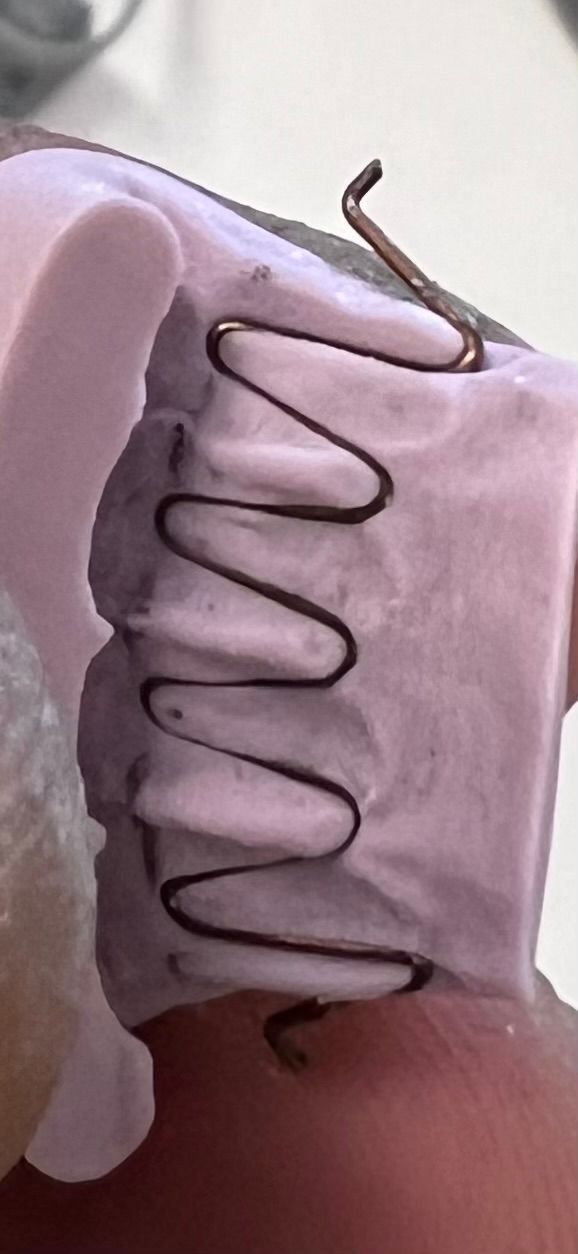 A person is holding a dental appliance in their hand.